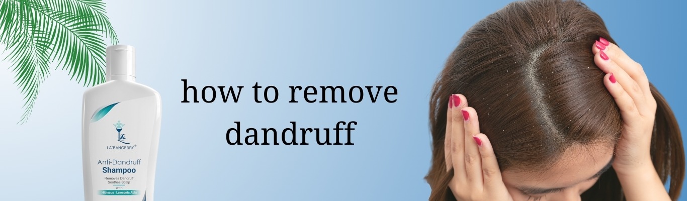 How To remove Dandruff At home